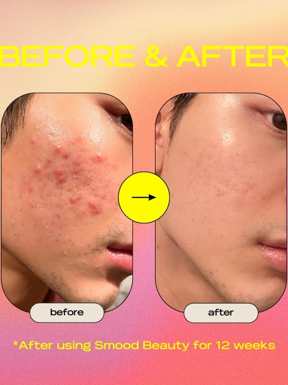 Problem Solver Gel-Cream Moisturizer - Picture 6 of 7